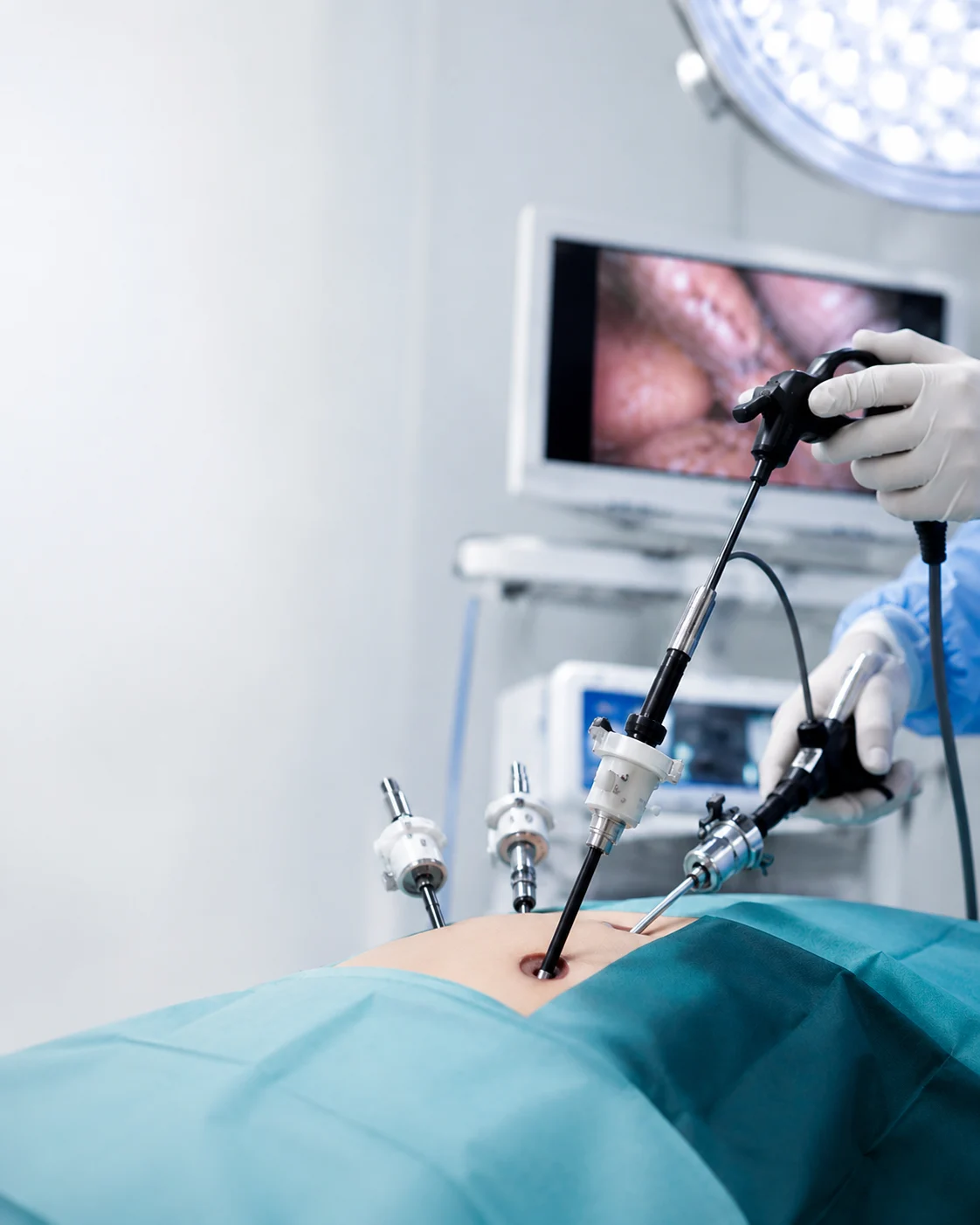 Minimally Invasive Cancer Surgery